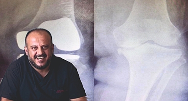 SİGARA VE AŞIRI KİLOLAR KIKIRDAKLARIN DA EN BÜYÜK DÜŞMANI