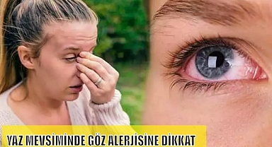 YAZ MEVSİMİNDE GÖZ ALERJİSİNE DİKKAT