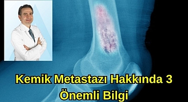 KEMİK METASTAZI HAKKINDA 3 ÖNEMLİ BİLGİ