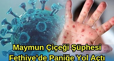 Maymun Çiçeği Şüphesi Fethiye'de Paniğe Yol Açtı