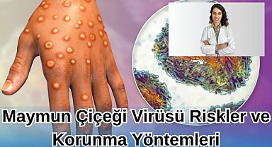 MAYMUN ÇİÇEĞİ VİRÜSÜ RİSKLER VE KORUNMA YÖNTEMLERİ