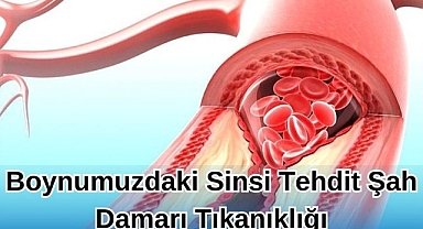 BOYNUMUZDAKİ SİNSİ TEHDİT ŞAH DAMARI TIKANIKLIĞI