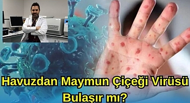 Havuzdan Maymun Çiçeği Virüsü Bulaşır mı? 