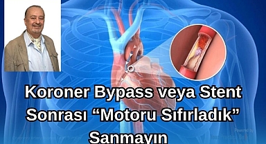 Koroner Bypass veya Stent Sonrası