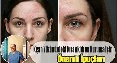 Kışın Yüzünüzdeki Kızarıklık ve Kuruma İçin Önemli İpuçları