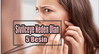 Sivilceye Neden Olan 5 Besin