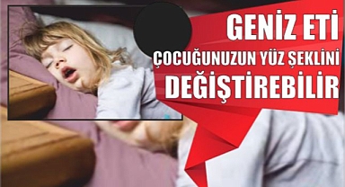 GENİZ ETİ ÇOCUĞUNUZUN YÜZ ŞEKLİNİ DEĞİŞTİREBİLİR 