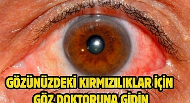 Gözünüzdeki kırmızılıklar için göz doktoruna gidin 