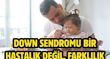 Down sendromu bir hastalık değil, farklılık