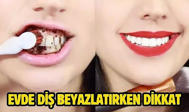 Evde diş beyazlatırken dikkat