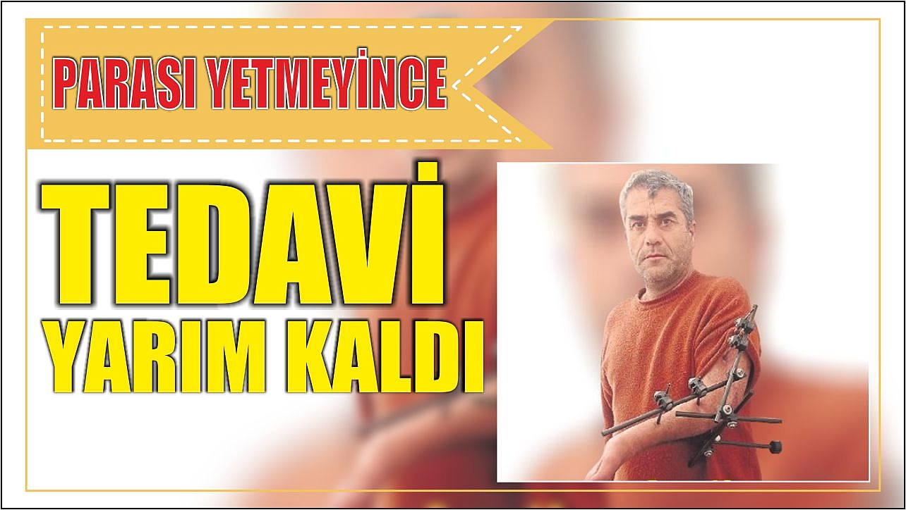 Parası Yetmeyince Tedavi Yarım Kaldı