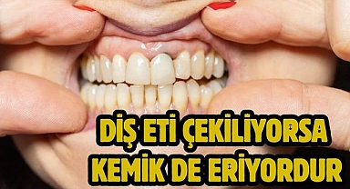 Diş eti çekiliyorsa kemik de eriyordur