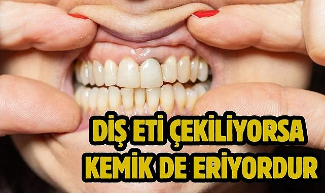 Diş eti çekiliyorsa kemik de eriyordur