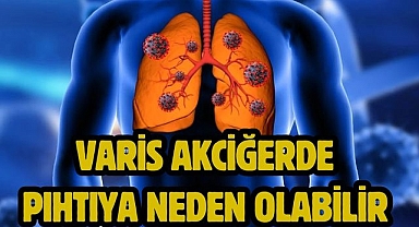 VARİS AKCİĞERDE PIHTIYA NEDEN OLABİLİR 